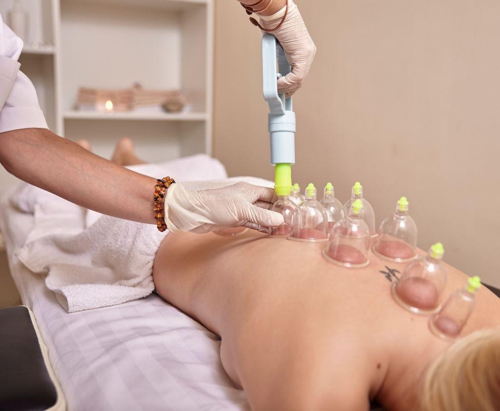 Cupping Therapy Benefits in Honolulu You Must Know